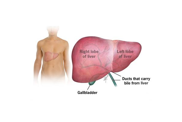 Liver Cancer