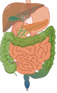 Detailed digestive system illustration used for expert second opinion consultation by gastroenterologist in Delhi